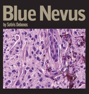 Debonos - Blue Nevus COVER