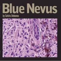 Σωτήρης Δεμπόνος - Blue Nevus